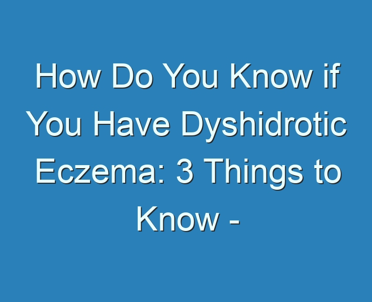 20+ Best How Do You Know if You Have Dyshidrotic Eczema 3 Things to